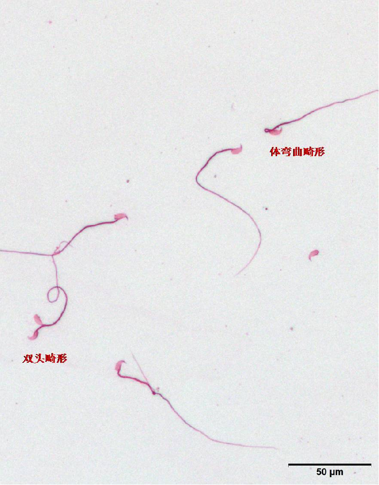 小鼠精子畸形检测